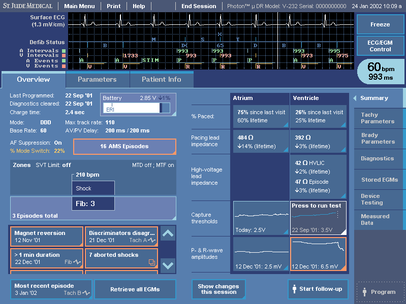 St. Jude Medical – ICD programming terminal